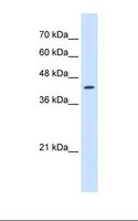 RNF165 Antibody - Jurkat cell lysate. Antibody concentration: 2.5 ug/ml. Gel concentration: 12%.  This image was taken for the unconjugated form of this product. Other forms have not been tested.