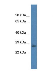 RNF166 Antibody - RNF166 antibody Western blot of Mouse Pancreas lysate. Antibody concentration 1 ug/ml.  This image was taken for the unconjugated form of this product. Other forms have not been tested.