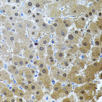RNF166 Antibody - Immunohistochemistry of paraffin-embedded human liver injury tissue.