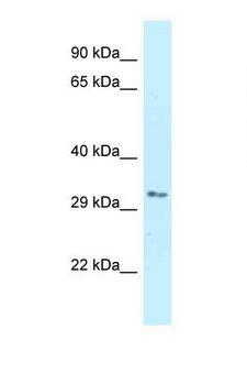 RNF167 Antibody - Western blot of Human Jurkat. RNF167 antibody dilution 1.0 ug/ml.  This image was taken for the unconjugated form of this product. Other forms have not been tested.