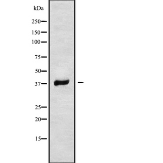 RNF167 Antibody - Western blot analysis of RNF167 using MCF-7 whole cells lysates