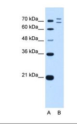 RNF168 Antibody - Lane A: Marker. Lane B: HepG2 cell lysate. Antibody concentration: 0.5 ug/ml. Gel concentration: 12%.  This image was taken for the unconjugated form of this product. Other forms have not been tested.