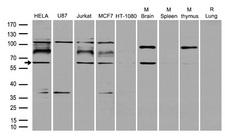 RNF168 Antibody - Western blot analysis of extracts. (35ug) from different cell lines or tissues by using anti-RNF168 rabbit polyclonal antibody .