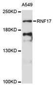 RNF17 Antibody - Western blot analysis of extracts of A-549 cells, using RNF17 antibody at 1:3000 dilution. The secondary antibody used was an HRP Goat Anti-Rabbit IgG (H+L) at 1:10000 dilution. Lysates were loaded 25ug per lane and 3% nonfat dry milk in TBST was used for blocking. An ECL Kit was used for detection and the exposure time was 90s.