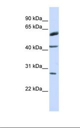 RNF170 Antibody - MCF7 cell lysate. Antibody concentration: 1.0 ug/ml. Gel concentration: 12%.  This image was taken for the unconjugated form of this product. Other forms have not been tested.