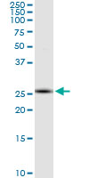 RNF170 Antibody - RNF170 monoclonal antibody (M01), clone 2D6. Western blot of RNF170 expression in Jurkat.