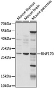 RNF170 Antibody - Western blot analysis of extracts of various cell lines, using RNF170 antibody at 1:1000 dilution. The secondary antibody used was an HRP Goat Anti-Rabbit IgG (H+L) at 1:10000 dilution. Lysates were loaded 25ug per lane and 3% nonfat dry milk in TBST was used for blocking. An ECL Kit was used for detection and the exposure time was 15s.