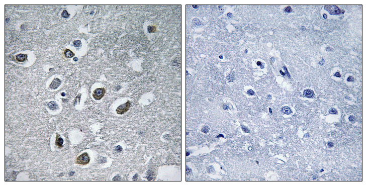 RNF174 / MARCH4 Antibody - Immunohistochemistry analysis of paraffin-embedded human brain tissue, using MARCH4 Antibody. The picture on the right is blocked with the synthesized peptide.