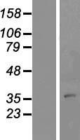 RNF174 / MARCH4 Protein - Western validation with an anti-DDK antibody * L: Control HEK293 lysate R: Over-expression lysate