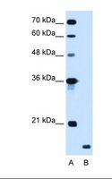 RNF175 Antibody - Lane A: Marker. Lane B: HepG2 cell lysate. Antibody concentration: 1.25 ug/ml. Gel concentration: 12%.  This image was taken for the unconjugated form of this product. Other forms have not been tested.