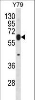 RNF180 Antibody - RNF180 Antibody western blot of Y79 cell line lysates (35 ug/lane). The RNF180 antibody detected the RNF180 protein (arrow).