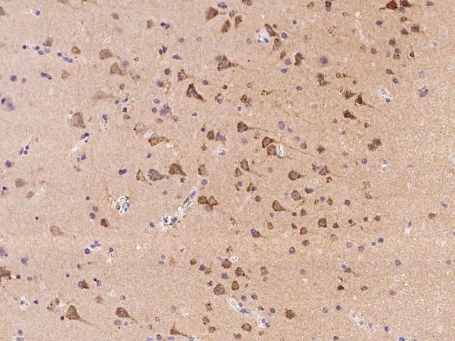 RNF180 Antibody - Immunochemical staining of human RNF180 in human brain with rabbit polyclonal antibody at 1:300 dilution, formalin-fixed paraffin embedded sections.