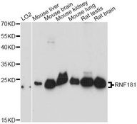 RNF181 Antibody - Western blot analysis of extracts of various cell lines, using RNF181 antibody at 1:3000 dilution. The secondary antibody used was an HRP Goat Anti-Rabbit IgG (H+L) at 1:10000 dilution. Lysates were loaded 25ug per lane and 3% nonfat dry milk in TBST was used for blocking. An ECL Kit was used for detection and the exposure time was 90s.
