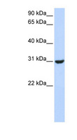 RNF182 Antibody - RNF182 antibody Western blot of Fetal Muscle lysate. This image was taken for the unconjugated form of this product. Other forms have not been tested.