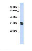 RNF182 Antibody - HepG2 cell lysate. Antibody concentration: 1.0 ug/ml. Gel concentration: 12%.  This image was taken for the unconjugated form of this product. Other forms have not been tested.
