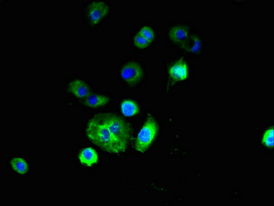 RNF182 Antibody - Immunofluorescent analysis of A431 cells using RNF182 Antibody at dilution of 1:100 and Alexa Fluor 488-congugated AffiniPure Goat Anti-Rabbit IgG(H+L)