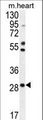RNF183 Antibody - RNF183 Antibody western blot of mouse heart tissue lysates (35 ug/lane). The RNF183 antibody detected the RNF183 protein (arrow).