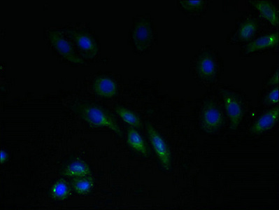 RNF183 Antibody - Immunofluorescent analysis of HepG2 cells using RNF183 Antibody at dilution of 1:100 and Alexa Fluor 488-congugated AffiniPure Goat Anti-Rabbit IgG(H+L)