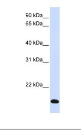 RNF185 Antibody - Fetal liver lysate. Antibody concentration: 1.0 ug/ml. Gel concentration: 12%.  This image was taken for the unconjugated form of this product. Other forms have not been tested.