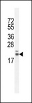 RNF185 Antibody - RN185 Antibody western blot of CHO cell line lysates (35 ug/lane). The RN185 antibody detected the RN185 protein (arrow).