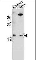 RNF185 Antibody - RN185 Antibody western blot of mouse kidney tissue and K562 cell line lysates (35 ug/lane). The RN185 antibody detected the RN185 protein (arrow).