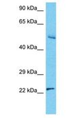 RNF187 Antibody - RNF187 antibody Western Blot of HepG2. Antibody dilution: 1 ug/ml.  This image was taken for the unconjugated form of this product. Other forms have not been tested.