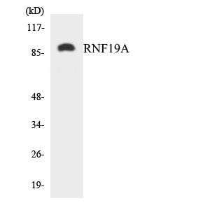 RNF19A / DORFIN Antibody - Western blot analysis of the lysates from Jurkat cells using RNF19A antibody.