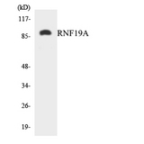 RNF19A / DORFIN Antibody - Western blot analysis of the lysates from Jurkat cells using RNF19A antibody.