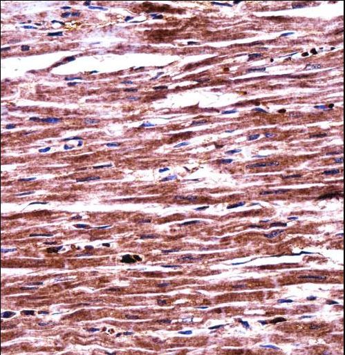 RNF19A / DORFIN Antibody - RNF19A Antibody immunohistochemistry of formalin-fixed and paraffin-embedded human heart tissue followed by peroxidase-conjugated secondary antibody and DAB staining.