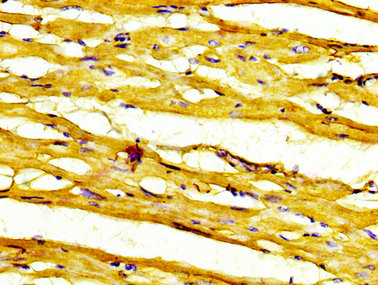 RNF19A / DORFIN Antibody - Immunohistochemistry image at a dilution of 1:200 and staining in paraffin-embedded human heart tissue performed on a Leica BondTM system. After dewaxing and hydration, antigen retrieval was mediated by high pressure in a citrate buffer (pH 6.0) . Section was blocked with 10% normal goat serum 30min at RT. Then primary antibody (1% BSA) was incubated at 4 °C overnight. The primary is detected by a biotinylated secondary antibody and visualized using an HRP conjugated SP system.