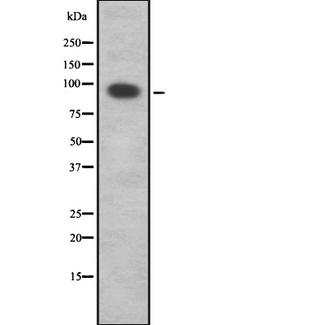 RNF19A / DORFIN Antibody - Western blot analysis of RNF19A using Jurkat whole cells lysates