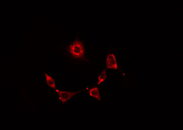 RNF19A / DORFIN Antibody - Staining HeLa cells by IF/ICC. The samples were fixed with PFA and permeabilized in 0.1% Triton X-100, then blocked in 10% serum for 45 min at 25°C. The primary antibody was diluted at 1:200 and incubated with the sample for 1 hour at 37°C. An Alexa Fluor 594 conjugated goat anti-rabbit IgG (H+L) antibody, diluted at 1/600, was used as secondary antibody.