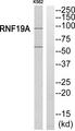 RNF19A / DORFIN Antibody - Western blot analysis of extracts from K562 cells, using RNF19A antibody.