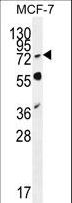 RNF19B Antibody - RNF19B Antibody western blot of MCF-7 cell line lysates (35 ug/lane). The RNF19B antibody detected the RNF19B protein (arrow).