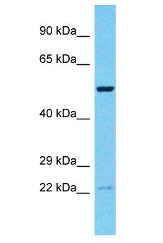 RNF19B Antibody - RNF19B antibody Western Blot of Jurkat. Antibody dilution: 1 ug/ml.  This image was taken for the unconjugated form of this product. Other forms have not been tested.