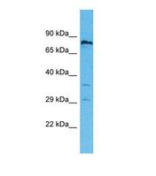 RNF19B Antibody - Western blot of Human 721_B. RNF19B antibody dilution 1.0 ug/ml.  This image was taken for the unconjugated form of this product. Other forms have not been tested.