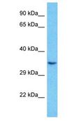 RNF2 / RING2 / RING1B Antibody - RING1B / BAP1 / RNF2 antibody Western Blot of MDA-MB-435s. Antibody dilution: 1 ug/ml.  This image was taken for the unconjugated form of this product. Other forms have not been tested.
