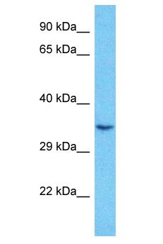 RNF2 / RING2 / RING1B Antibody - RING1B / BAP1 / RNF2 antibody Western Blot of MDA-MB-435s. Antibody dilution: 1 ug/ml.  This image was taken for the unconjugated form of this product. Other forms have not been tested.