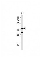 RNF2 / RING2 / RING1B Antibody - Anti-Rnf2 Antibody at 1:1000 dilution + F9 whole cell lysates Lysates/proteins at 20 ug per lane. Secondary Goat Anti-Rabbit IgG, (H+L), Peroxidase conjugated at 1/10000 dilution Predicted band size : 38 kDa Blocking/Dilution buffer: 5% NFDM/TBST.