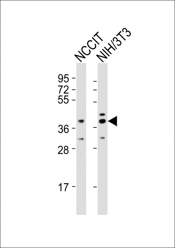 RNF2 / RING2 / RING1B Antibody - All lanes : Anti-Rnf2 Antibody at 1:2000 dilution Lane 1: NCCIT whole cell lysates Lane 2: NIH/3T3 whole cell lysates Lysates/proteins at 20 ug per lane. Secondary Goat Anti-Rabbit IgG, (H+L), Peroxidase conjugated at 1/10000 dilution Predicted band size : 38 kDa Blocking/Dilution buffer: 5% NFDM/TBST.