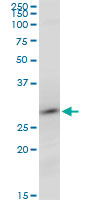 RNF2 / RING2 / RING1B Antibody - RNF2 monoclonal antibody (M14), clone 2B4. Western blot of RNF2 expression in PC-12.