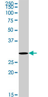 RNF2 / RING2 / RING1B Antibody - RNF2 monoclonal antibody (M14), clone 2B4. Western blot of RNF2 expression in HepG2.