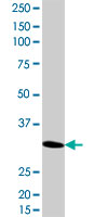 RNF2 / RING2 / RING1B Antibody - RNF2 monoclonal antibody (M14), clone 2B4. Western blot of RNF2 expression in A-549.