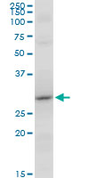 RNF2 / RING2 / RING1B Antibody - RNF2 monoclonal antibody (M14), clone 2B4. Western blot of RNF2 expression in NIH/3T3.