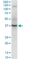 RNF2 / RING2 / RING1B Antibody - RNF2 monoclonal antibody (M05), clone 2B6. Western blot of RNF2 expression in PC-12.