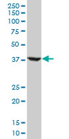 RNF2 / RING2 / RING1B Antibody - RNF2 monoclonal antibody (M05), clone 2B6. Western blot of RNF2 expression in HeLa NE.