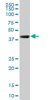 RNF2 / RING2 / RING1B Antibody - RNF2 monoclonal antibody (M03), clone 3G6. Western blot of RNF2 expression in human stomach.
