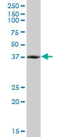 RNF2 / RING2 / RING1B Antibody - RNF2 monoclonal antibody (M06), clone 4A9. Western blot of RNF2 expression in human placenta.