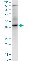 RNF2 / RING2 / RING1B Antibody - RNF2 monoclonal antibody (M06), clone 4A9. Western blot of RNF2 expression in PC-12.