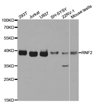 RNF2 / RING2 / RING1B Antibody - Western blot analysis of extracts of various cell lines, using RNF2 antibody.